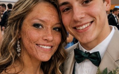 A Popular Boy Asked Me to Dance at Prom When Everyone Else Avoided Me Because of My Scars — The Next Morning, His Parents and the Police Arrived at My House