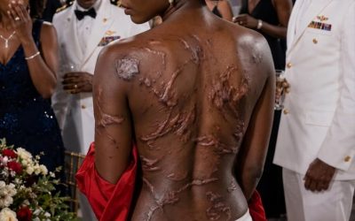 My sister ripped my shirt apart in front of two hundred guests and laughed at the scars across my back. For one stunned moment, even the champagne seemed to stand still.
