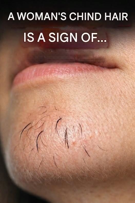 Why Chin Hair Grows in Women and What It May Indicate 0