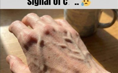 If your veins are visible, it means you are… See more